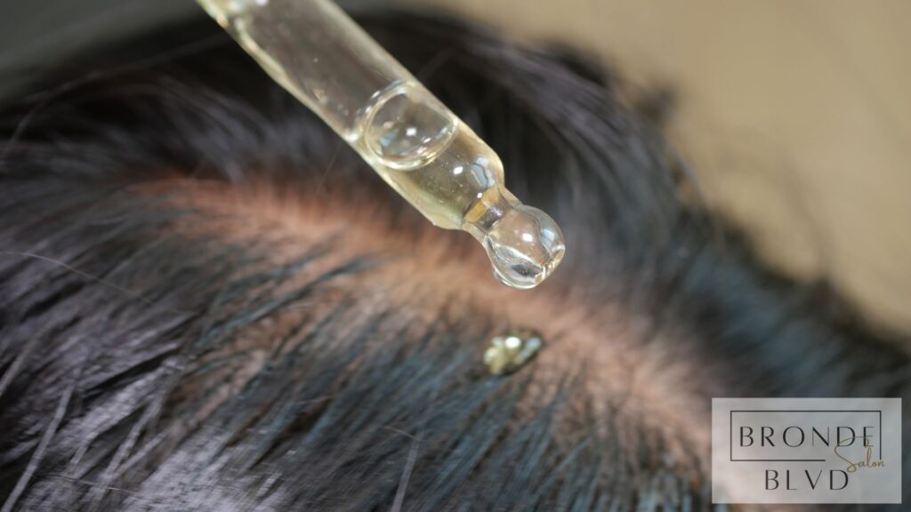 Winter Hair Care Preventing Dry Scalp